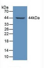 LTBP1 Antibody in Western Blot (WB)
