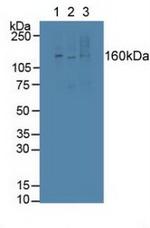 LTBP1 Antibody in Western Blot (WB)