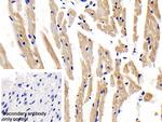 LEPR Polyclonal Antibody