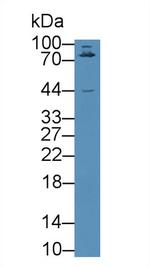 GARP Antibody in Western Blot (WB)