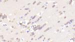 PIDD Polyclonal Antibody