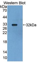 PIDD Antibody in Western Blot (WB)