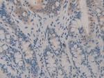 SERPINB1 Antibody in Immunohistochemistry (Paraffin) (IHC (P))