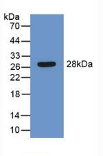 SERPINB1 Antibody in Western Blot (WB)