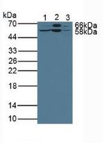 LSR Antibody in Western Blot (WB)