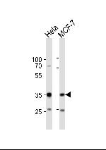SNAIL Polyclonal Antibody