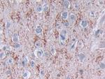 TDH Polyclonal Antibody