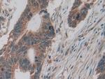 LTBR Antibody in Immunohistochemistry (Paraffin) (IHC (P))