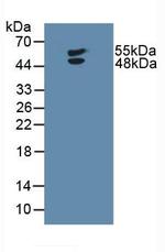 LTBR Antibody in Western Blot (WB)