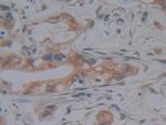 JMJD2A Antibody in Immunohistochemistry (Paraffin) (IHC (P))