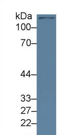 JMJD2A Antibody in Western Blot (WB)