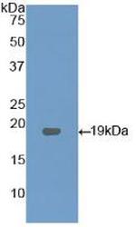 LPCAT3 Polyclonal Antibody