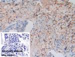 HLA-C Antibody in Immunohistochemistry (Paraffin) (IHC (P))