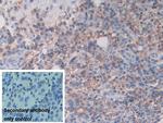 HLA-C Antibody in Immunohistochemistry (Paraffin) (IHC (P))
