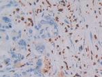 MASP1 Polyclonal Antibody