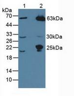 MASP1 Antibody in Western Blot (WB)