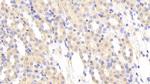 MASP1 Polyclonal Antibody