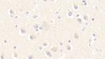 MPI Polyclonal Antibody