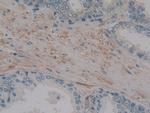 MMP14 Polyclonal Antibody