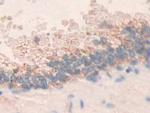 MMP24 Antibody in Immunohistochemistry (Paraffin) (IHC (P))