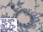 MMP9 Antibody in Immunohistochemistry (Paraffin) (IHC (P))
