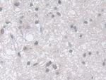 MPP5 Antibody in Immunohistochemistry (Paraffin) (IHC (P))