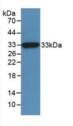 Mgea5 Antibody in Western Blot (WB)