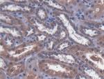 MTX1 Antibody in Immunohistochemistry (Paraffin) (IHC (P))