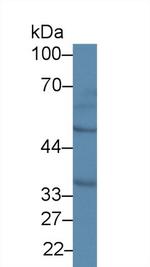 MTX1 Antibody in Western Blot (WB)