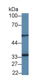 MTX1 Antibody in Western Blot (WB)