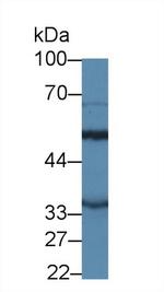 MTX1 Antibody in Western Blot (WB)