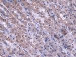 MTX1 Polyclonal Antibody