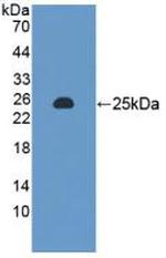 MTX1 Antibody in Western Blot (WB)