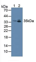 MTX1 Antibody in Western Blot (WB)