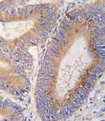 GDF11 Polyclonal Antibody