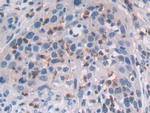 MAT2A Antibody in Immunohistochemistry (Paraffin) (IHC (P))