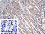 MARS Polyclonal Antibody