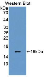 MARS Antibody in Western Blot (WB)