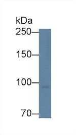 MARS Antibody in Western Blot (WB)