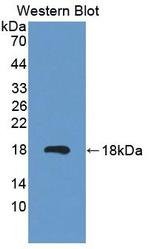 MARS Antibody in Western Blot (WB)