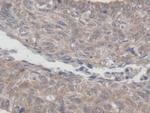 MRPL1 Antibody in Immunohistochemistry (Paraffin) (IHC (P))