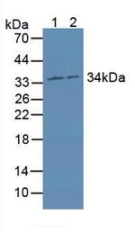 MRPL1 Antibody in Western Blot (WB)