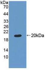 MRPL1 Antibody in Western Blot (WB)