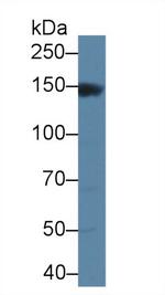 MAP3K6 Antibody in Western Blot (WB)