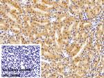 MOSC1 Polyclonal Antibody