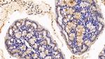 MUC2 Antibody in Immunohistochemistry (Paraffin) (IHC (P))