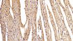 MYH2 Polyclonal Antibody