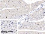 MYH7 Polyclonal Antibody
