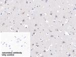 MYH7 Antibody in Immunohistochemistry (Paraffin) (IHC (P))