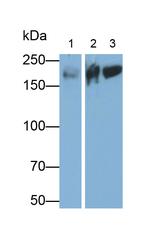 MYH7 Antibody in Western Blot (WB)